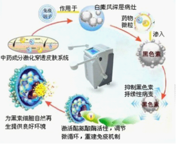 中药微粒子热雾